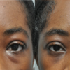 VShell ANTI-AGEING eye and Face cream