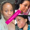Skin Brightening Glutathione Gummies