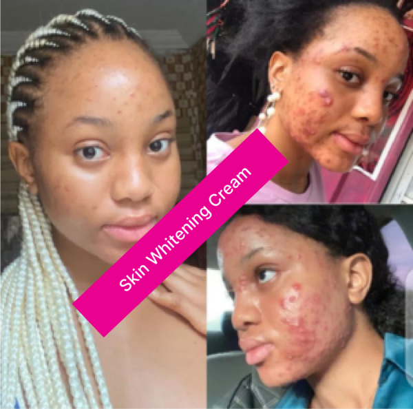Skin Brightening Glutathione Gummies