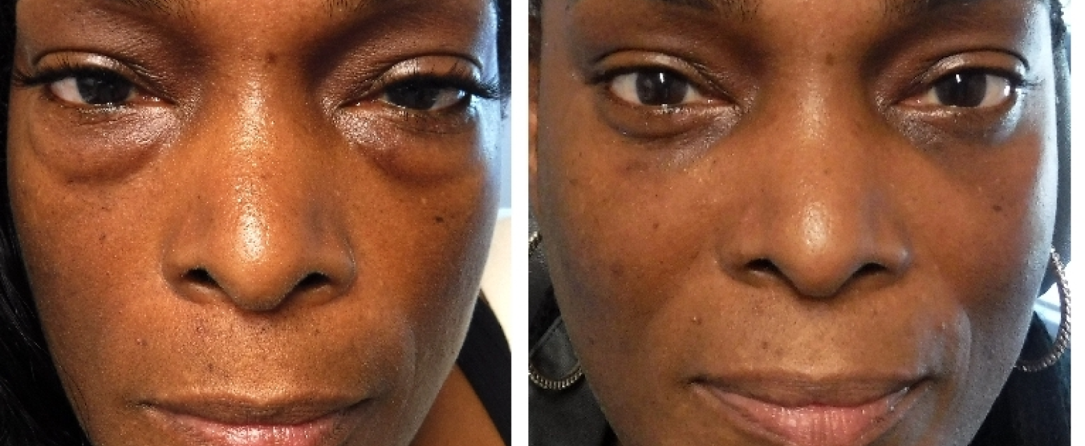 Before and after5